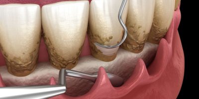 Modern-Smiles-7-scaled-1