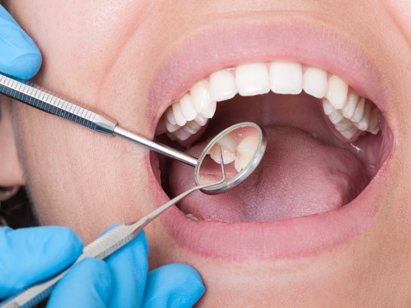 can-i-drive-after-getting-a-tooth-extraction-blog