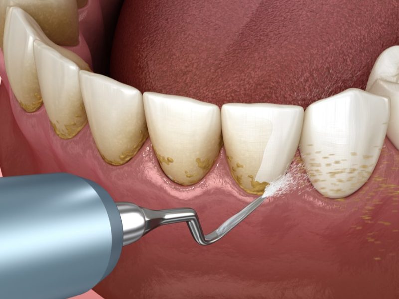 shutterstock_1486975724-min